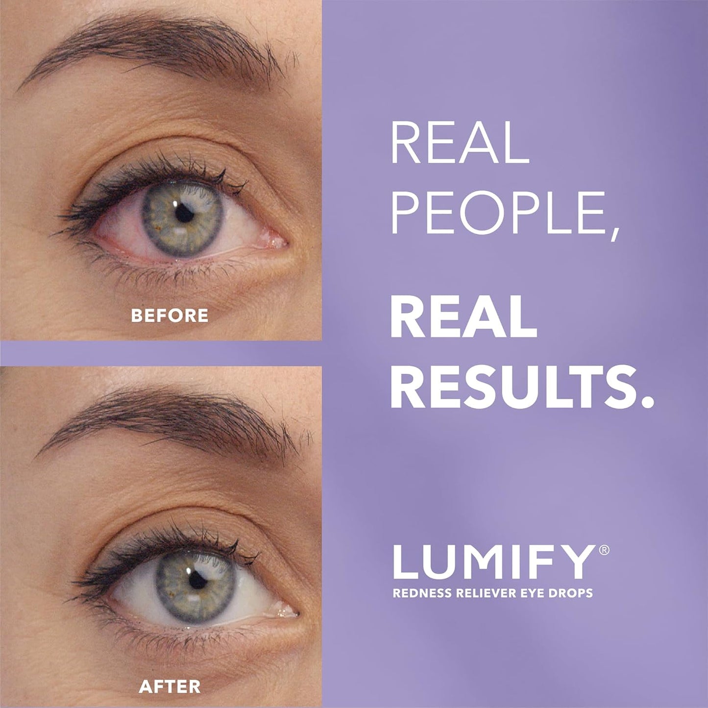 Lumify, Redness Reliever Eye Drops