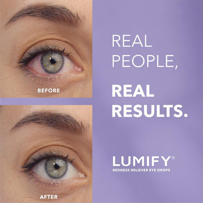 Lumify, Redness Reliever Eye Drops